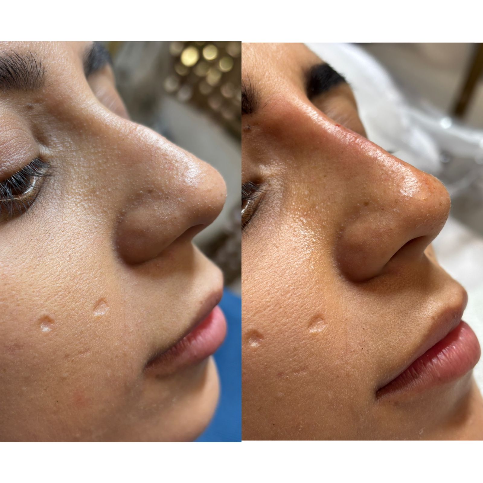 Resultado de Tratamiento de Piel