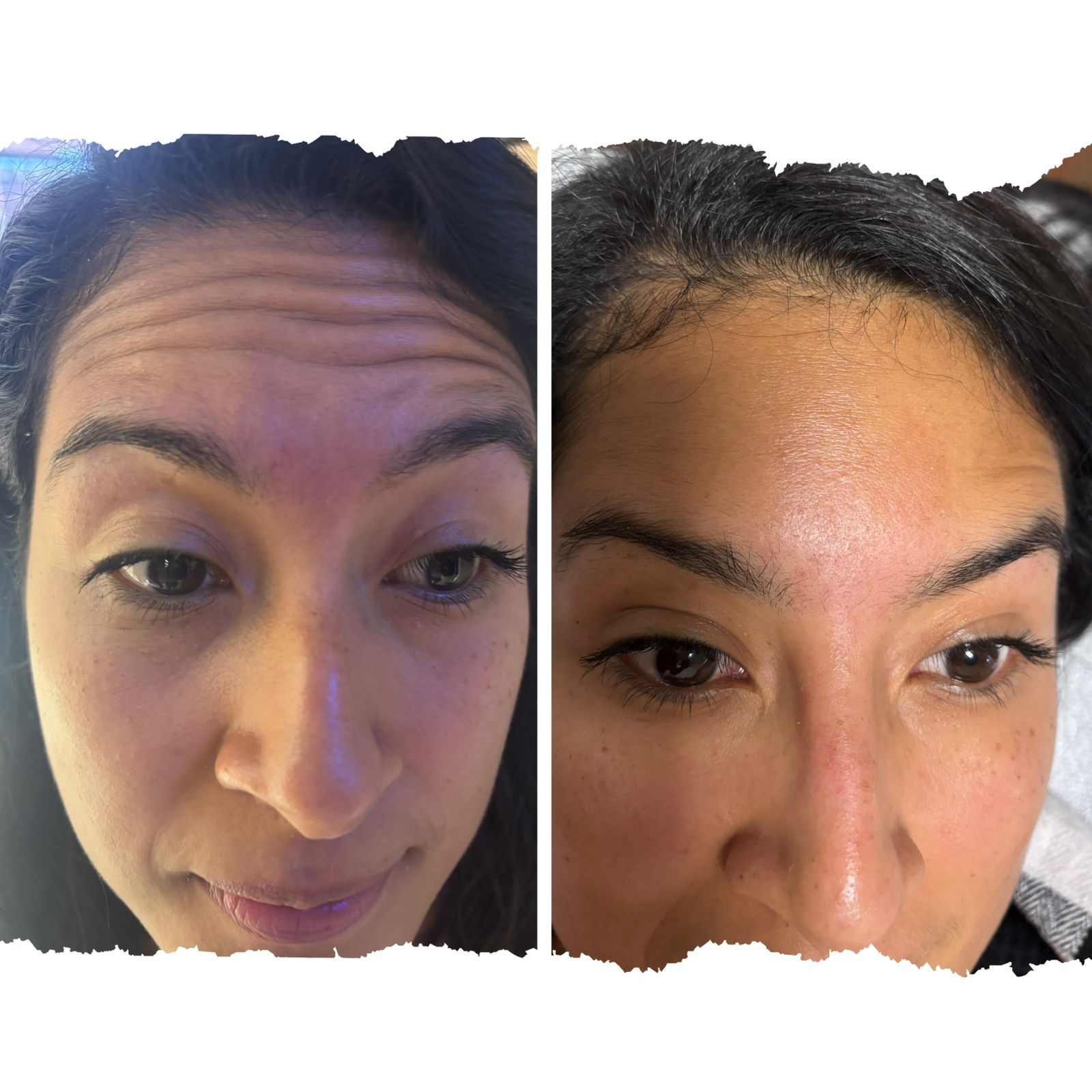 Resultado de Rejuvenecimiento