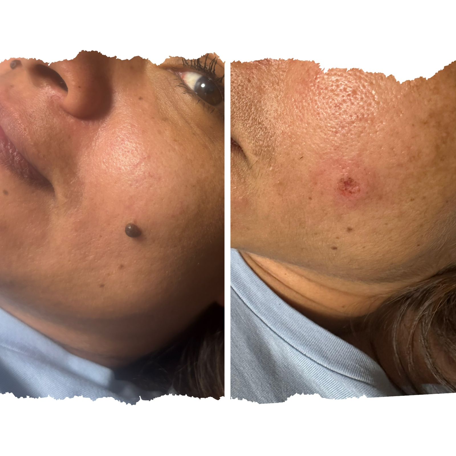 Resultado de Cuidado Facial